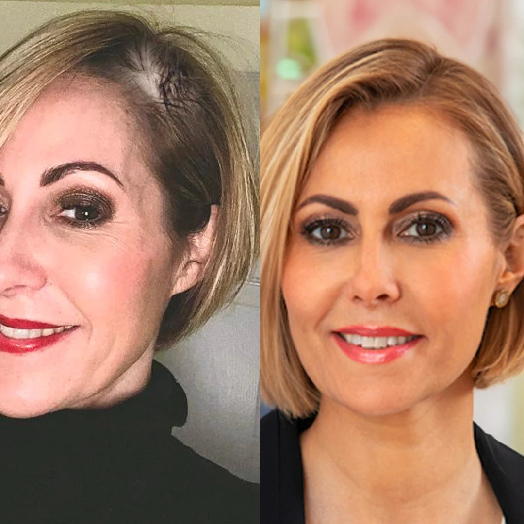 BELORA™ Aceite de Ricino + Romero